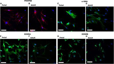 Pericyte Contractile Responses to Endothelin-1 and Aβ Peptides: Assessment by Electrical Impedance Assay